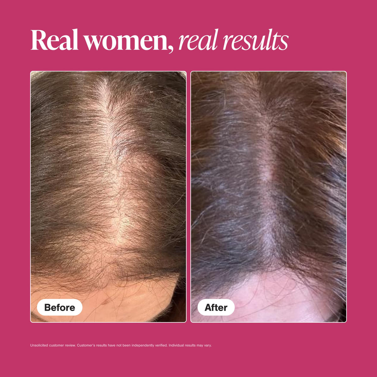 Hair Growth Supplements for Women, 60 Tablets C7900